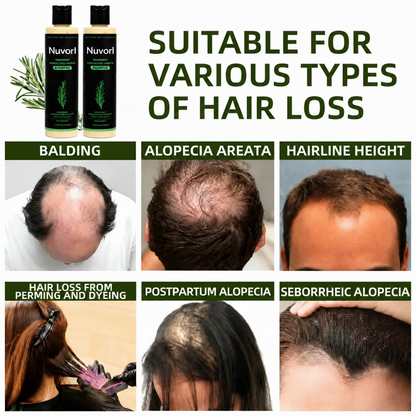 Organic Rosemary Hair Growth Shampoo
